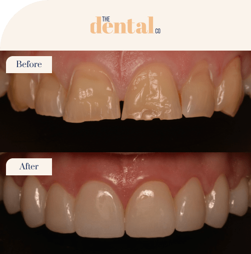 before-and-after-3-min